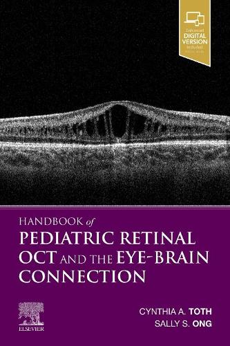 Бумажная книга «Handbook of Pediatric Retinal OCT and the Eye-Brain Connection», автор Синтия А. Тот - фото №1