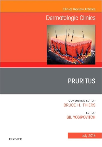 Паперова книга «Pruritus, An Issue of Dermatologic Clinics», автор Гіл Йосипович - фото №1
