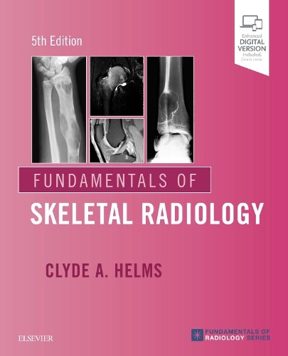 Бумажная книга «Fundamentals of Skeletal Radiology», автор Клайд А. Хелмс - фото №1