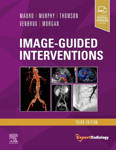 Бумажная книга «Image-Guided Interventions: Expert Radiology Series», автор Кеннет Р. Томсон - фото №1