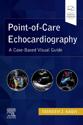 Паперова книга «Point-of-Care Echocardiography: A Clinical Case-Based Visual Guide», автор Таснім З. Накві - фото №1