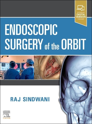 Бумажная книга «Endoscopic Surgery of the Orbit», автор Радж Синдвани - фото №1