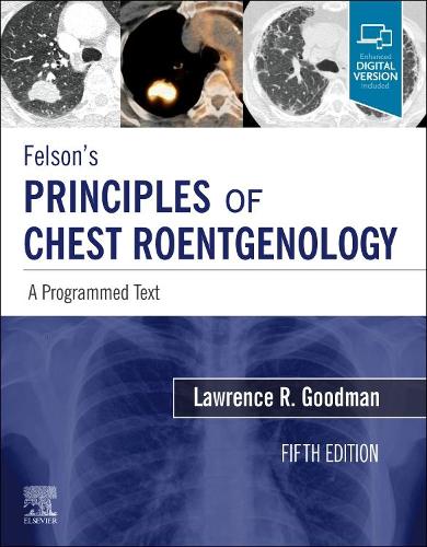 Паперова книга «Felson's Principles of Chest Roentgenology, A Programmed Text: A Programmed Text», автор Лоуренс Р. Гудман - фото №1