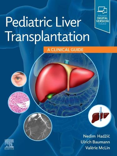 Бумажная книга «Pediatric Liver Transplantation: A Clinical Guide», авторов Недим Хаджич, Ульрих Бауманн, Валери Маклин - фото №1