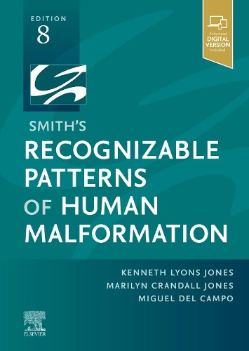 Паперова книга «Smith's Recognizable Patterns of Human Malformation», авторів Кеннет Лайонс Джонс, Мерилін Крендалл Джонс, Мігель дель Кампо - фото №1