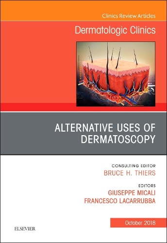 Бумажная книга «Alternative Uses of Dermatoscopy, An Issue of Dermatologic Clinics», авторов Франческо Лакаррубба, Джузеппе Микали - фото №1