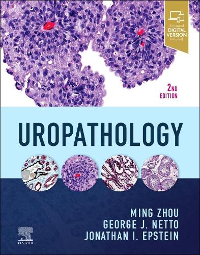 Бумажная книга «Uropathology», авторов Джордж Нетто, Джонатан И. Эпштейн, Минг Чжоу - фото №1