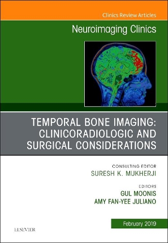 Паперова книга «Temporal Bone Imaging: Clinicoradiologic and Surgical Considerations, An Issue of Neuroimaging Clinics of North America», авторів Емі Фан-Є Джуліано, Гюль Муніс - фото №1