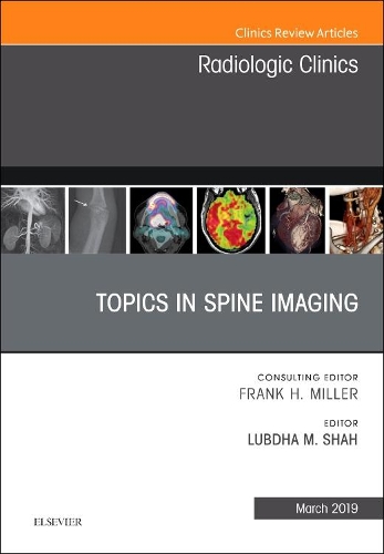 Бумажная книга «Topics in Spine Imaging, An Issue of Radiologic Clinics of North America», автор Лубда М. Шах - фото №1