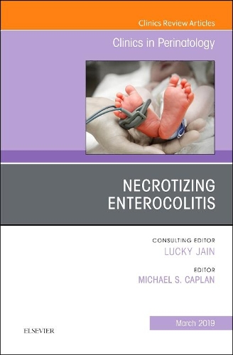 Паперова книга «Necrotizing Enterocolitis, An Issue of Clinics in Perinatology», автор Майкл С. Каплан - фото №1