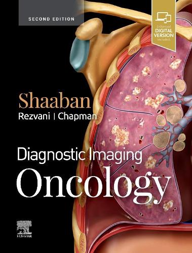 Бумажная книга «Diagnostic Imaging: Oncology», автор Акрам М. Шаабан - фото №1