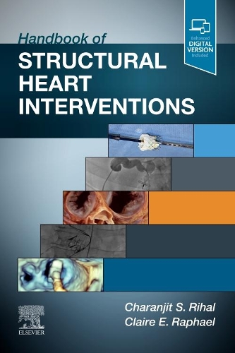 Паперова книга «Handbook of Structural Heart Interventions», авторів Чаранджит С Ріхал, Клер Рафаель - фото №1