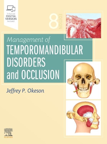 [object Object] «Management of Temporomandibular Disorders and Occlusion», автор Джеффри П. Окесон - фото №1