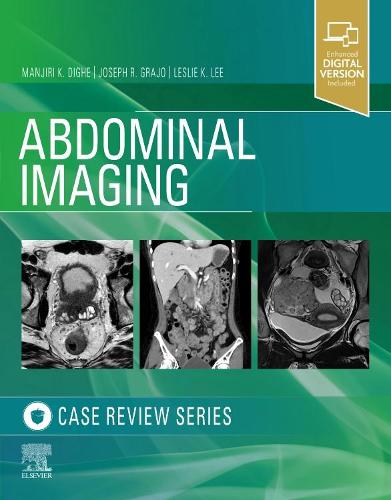 Паперова книга «Abdominal Imaging: Case Review Series», авторів Джозеф Р. Граджо, Леслі Лі, Манджірі Дігхе - фото №1
