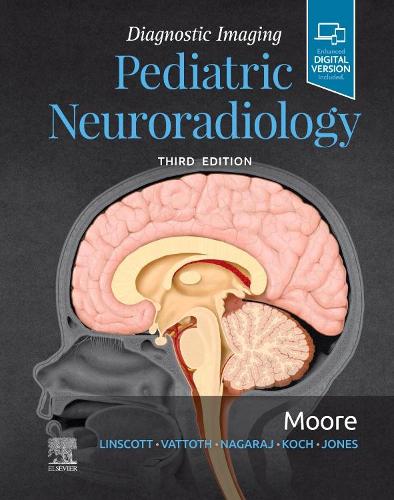 Бумажная книга «Diagnostic Imaging: Pediatric Neuroradiology», автор Кевин Р. Мур - фото №1