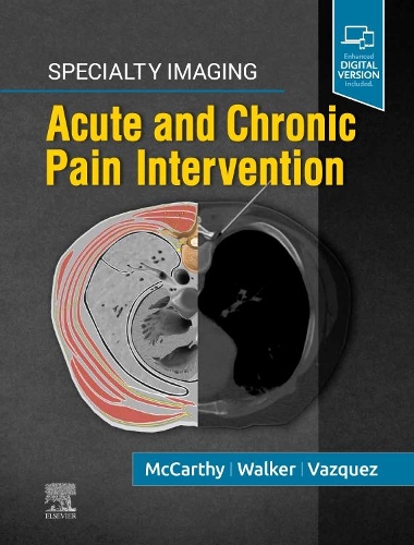 Паперова книга «Specialty Imaging: Acute and Chronic Pain Intervention», авторів Колін Дж. Маккарті, Рафаель Васкес, Т. Грегорі Вокер - фото №1