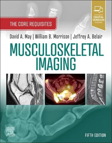 Бумажная книга «Musculoskeletal Imaging: The Core Requisites», авторов Дэвид А. Мэй, Джеффри А. Белэр, Уильям Б. Моррисон - фото №1