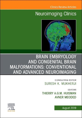 Паперова книга «Brain Embryology and the Cause of Congenital Malformations, An Issue of Neuroimaging Clinics of North America», авторів Авнер Меодед, Тьєррі А. Г. М. Гюйсман - фото №1