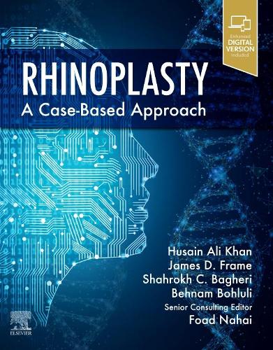 Паперова книга «Rhinoplasty: a Case-based approach», авторів Бехнам Болулі, Фоад Нахай, Хусейн Алі Хан, Джеймс Д. Фрейм, Шахрох К. Багері - фото №1