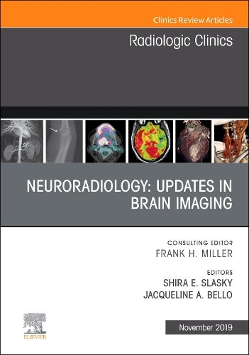Паперова книга «Neuroradiology, An Issue of Radiologic Clinics of North America», авторів Жаклін А Белло, Шира Е. Сласкі - фото №1