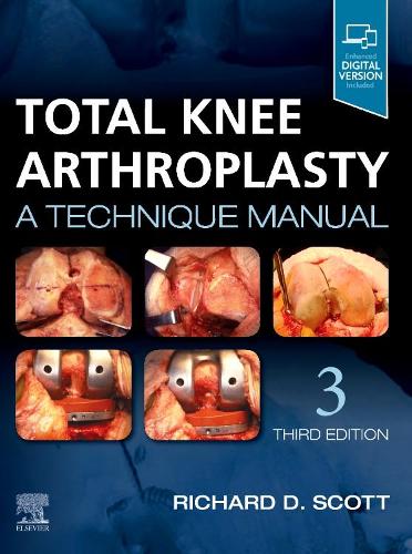 Бумажная книга «Total Knee Arthroplasty: A Technique Manual», автор Ричард Д. Скотт - фото №1