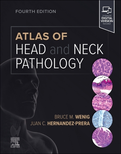 Паперова книга «Atlas of Head and Neck Pathology», авторів Брюс М. Веніг, Хуан К. Ернандес-Прера - фото №1
