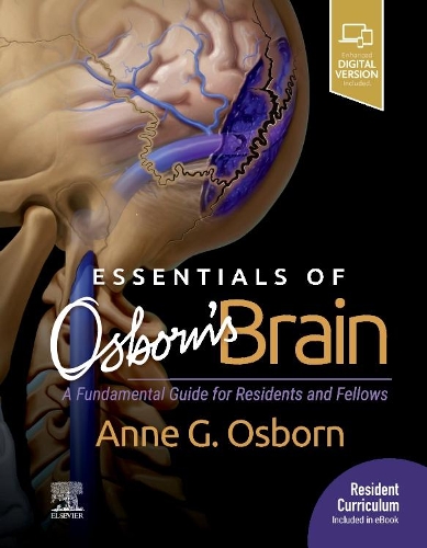 Бумажная книга «Essentials of Osborn's Brain: A Fundamental Guide for Residents and Fellows», автор Энн Дж. Осборн - фото №1