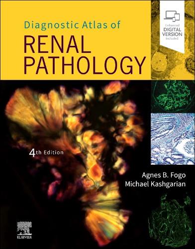 Бумажная книга «Diagnostic Atlas of Renal Pathology», авторов Агнес Б. Фого, Майкл Кашгарян - фото №1