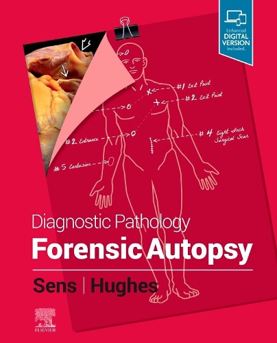 Паперова книга «Diagnostic Pathology: Forensic Autopsy», авторів Мері Енн Сенс, Ром Г'юз - фото №1