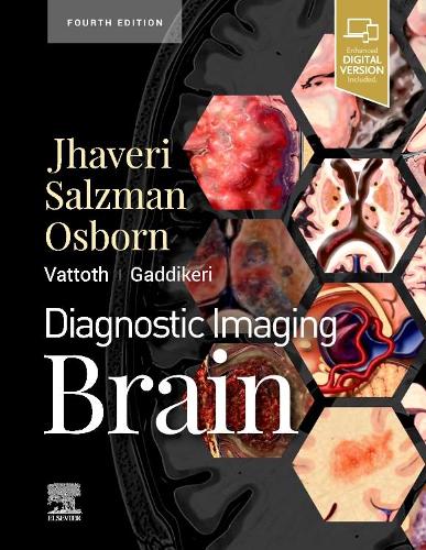 Бумажная книга «Diagnostic Imaging: Brain», автор Мирал Д. Джхавери - фото №1