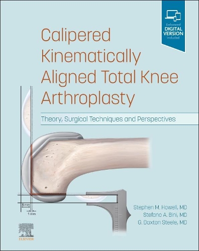 Бумажная книга «Calipered Kinematically aligned Total Knee Arthroplasty: Theory, Surgical Techniques and Perspectives», авторов Г. Дакстон Стил, Стефано А. Бини, Стивен М. Хауэлл - фото №1
