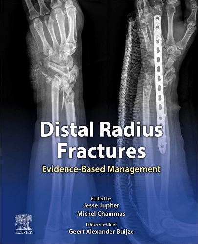 Бумажная книга «Distal Radius Fractures: Evidence-Based Management» - фото №1