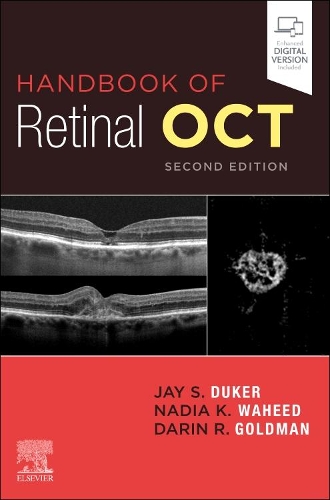 Паперова книга «Handbook of Retinal OCT: Optical Coherence Tomography», авторів Дарін Голдман, Джей С. Дюкер, Надя К. Вахід - фото №1