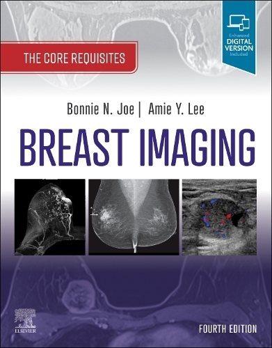 Паперова книга «Breast Imaging: The Core Requisites», авторів Амі Й. Лі, Бонні Н. Джо - фото №1