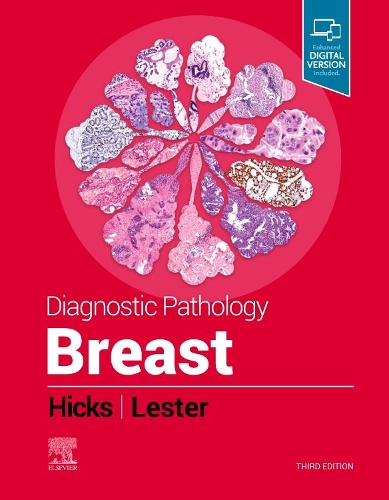 Паперова книга «Diagnostic Pathology: Breast», авторів Девід Г. Хікс, Сюзан К. Лестер - фото №1