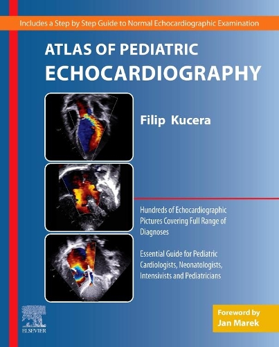 Паперова книга «Atlas of Pediatric Echocardiography», автор Філіп Кучера - фото №1