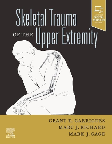 Паперова книга «Skeletal Trauma of the Upper Extremity» - фото №1