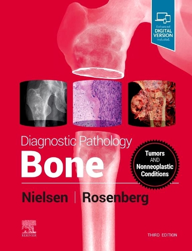 Бумажная книга «Diagnostic Pathology: Bone», авторов Эндрю Э. Розенберг, Г. Петур Нильсен - фото №1
