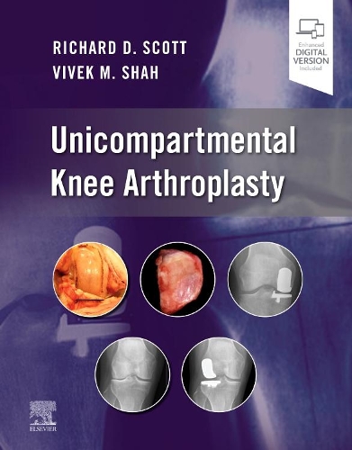 Бумажная книга «Unicompartmental Knee Arthroplasty», авторов Ричард Д. Скотт, Вивек Шах - фото №1