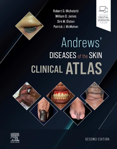 Паперова книга «Andrews' Diseases of the Skin Clinical Atlas», авторів Дірк М. Елстон, Патрік Дж. МакМахон, Роберт Г. Мікелетті, Вільям Д. Джеймс - фото №1