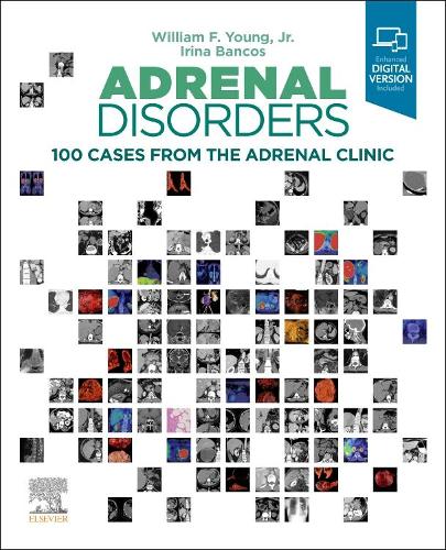 Паперова книга «Adrenal Disorders: 100 Cases from the Adrenal Clinic», авторів Ірина Банкос, Вільям Ф. Янг - фото №1