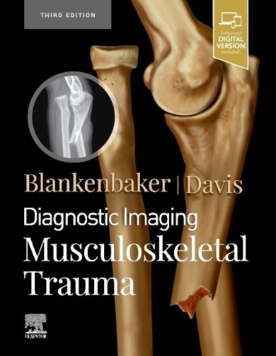 Паперова книга «Diagnostic Imaging: Musculoskeletal Trauma», авторів Донна Г. Бланкенбейкер, Кіркленд В. Девіс - фото №1