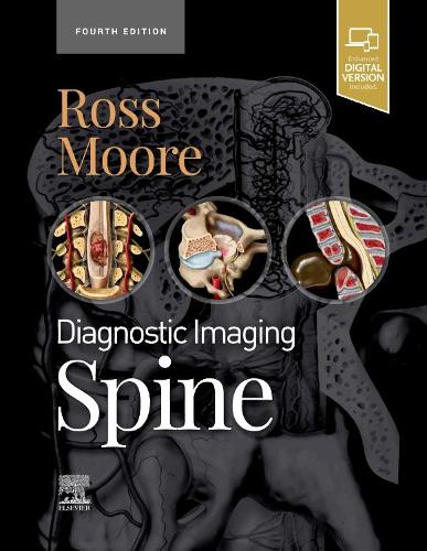 Бумажная книга «Diagnostic Imaging: Spine», авторов Джеффри С. Росс, Кевин Р. Мур - фото №1