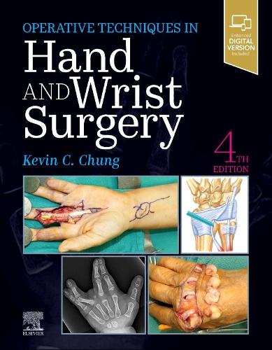 Бумажная книга «Operative Techniques: Hand and Wrist Surgery», автор Кевин К. Чанг - фото №1