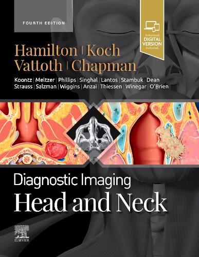 Бумажная книга «Diagnostic Imaging: Head and Neck», авторов Бернадетт Л. Кох, Филип Р. Чепмен, Сурджит Ваттот - фото №1