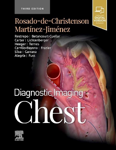 Паперова книга «Diagnostic Imaging: Chest», авторів Мелісса Л. Росадо-де-Крістенсон, Сантьяго Мартінес-Хіменес - фото №1
