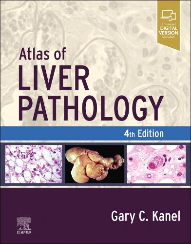 Бумажная книга «Atlas of Liver Pathology», автор Гэри К. Канел - фото №1