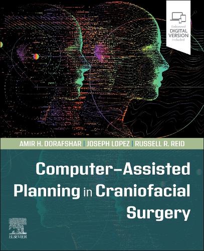 Паперова книга «Computer-Assisted Planning in Craniofacial Surgery», авторів Амір Х. Дорафшар, Джозеф Лопес, Рассел Р. Рід - фото №1