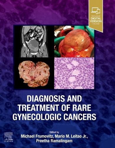 Бумажная книга «Diagnosis and Treatment of Rare Gynecologic Cancers», авторов Марио М. Лейтао мл., Майкл Фрумовиц, Преета Рамалингам - фото №1