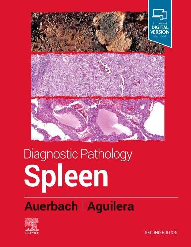 Бумажная книга «Diagnostic Pathology: Spleen», авторов Аарон Ауэрбах, Надин Агилера - фото №1